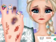 Play Elsa Foot Injured Game on FOG.COM