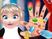 Play Baby Elsa Hand Doctor Game on FOG.COM