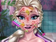 Play Ice Queen Skin Doctor Game on FOG.COM