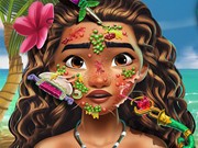 Play Moana Skin Doctor Game on FOG.COM