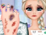 Play Elsa Foot Injured Game on FOG.COM