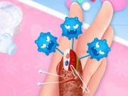 Play Beauty's Thumb Emergency Game on FOG.COM